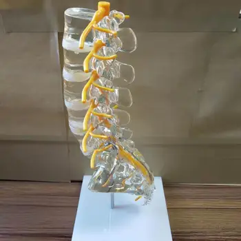 Прозрачен модел на лумбалния отдел на гръбначния стълб с копчиком Межпозвоночный диск на Гръбначния нерв Задницата опашката позвонок Ортопедическое 3D обучение